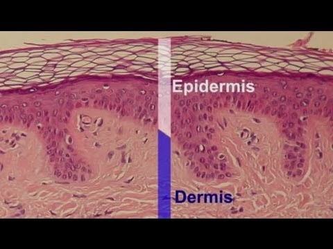 What Effect Does a Skin Peel Have & What Skin Layers Does It Remov... : Professional Skin Care Help