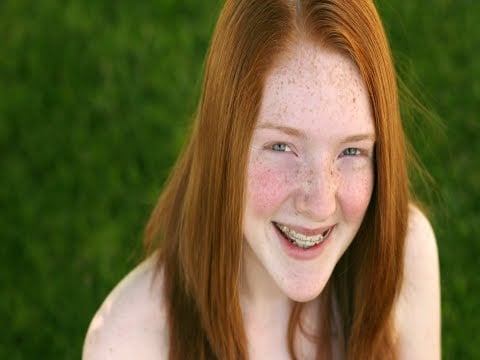 The 411 on Freckles and Age Spots (Beauty & Grooming Guru)