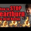 How to STOP Heartburn, Acid Reflux, Digestive Pain, Leaky Gut, Nutrition | The Truth Talks